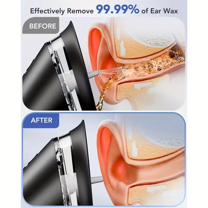 ClerWax™ Electric Ear Wax Removal Kit